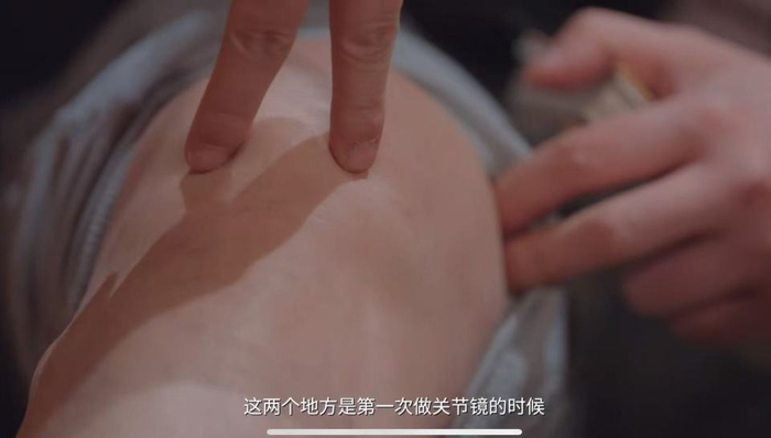 丁彦雨航股四头肌肌腱问题持续困扰 多年未愈难